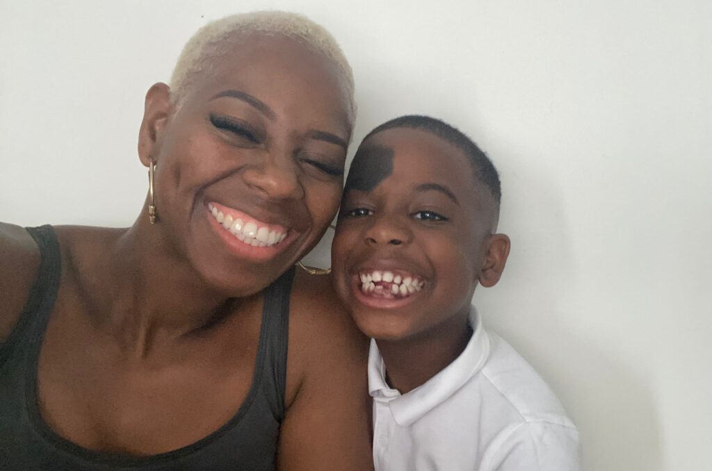 A young boy and his mother are sat together smiling. You young boy has a birthmark on his forehead.